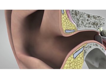 Personal Protective Equipment - Hearing Protection: Ears and Sound (Course)