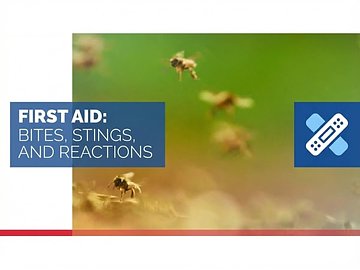 First Aid: Bites, Stings, and Reactions