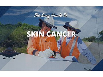 The Easy Guide to Skin Cancer